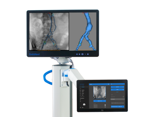 EndoNaut Image fusion workstation