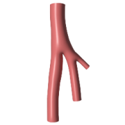 Peripheral arterial disease planning workflow