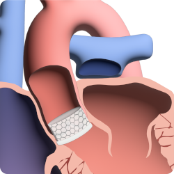 TAVI module icon.